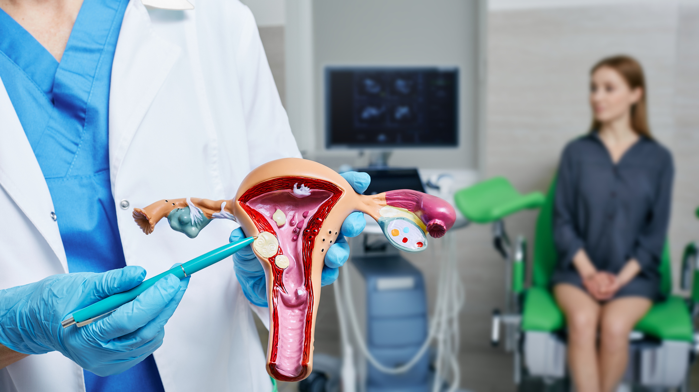 Mioma uterino: o que é e quais são os impactos na saúde da mulher